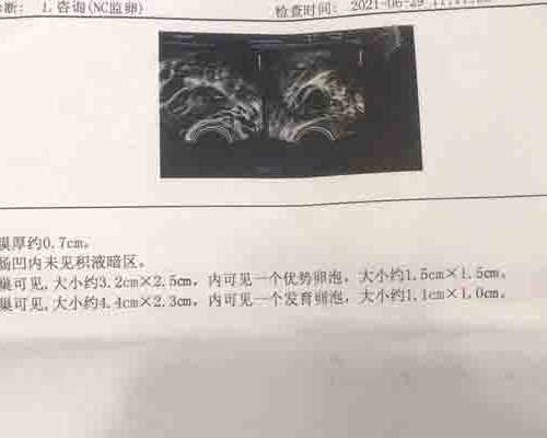 不完全纵隔子宫胚胎移植多少钱~试管生子医院