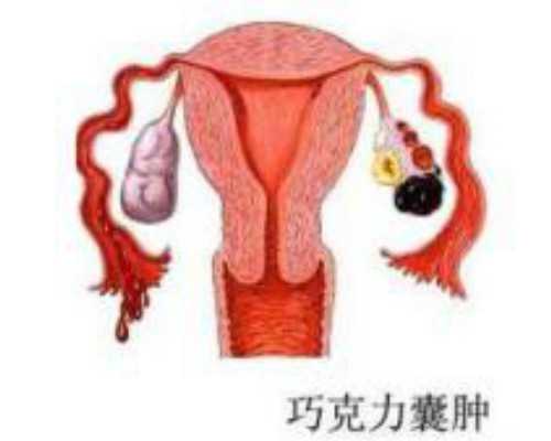 排卵障碍跟什么因素有关排卵障碍需哪些辅助治疗